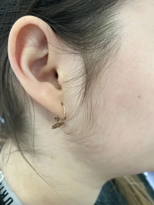 Pajesz szőrtelenítés